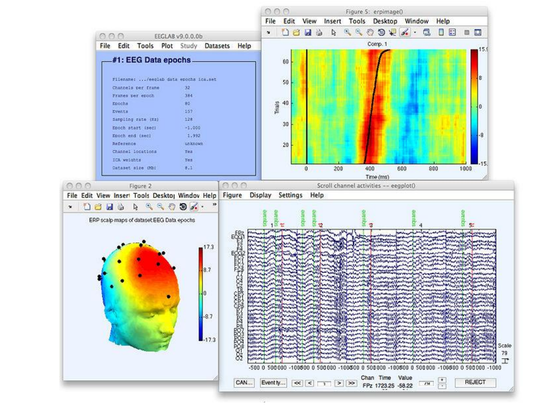 Brain Interface Machine for post-stroke rehabilitation